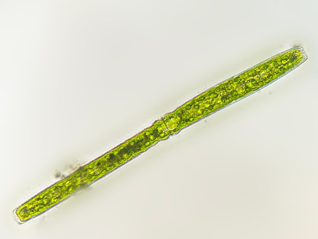Sieralg (pleurotaenium ehrenbergii)