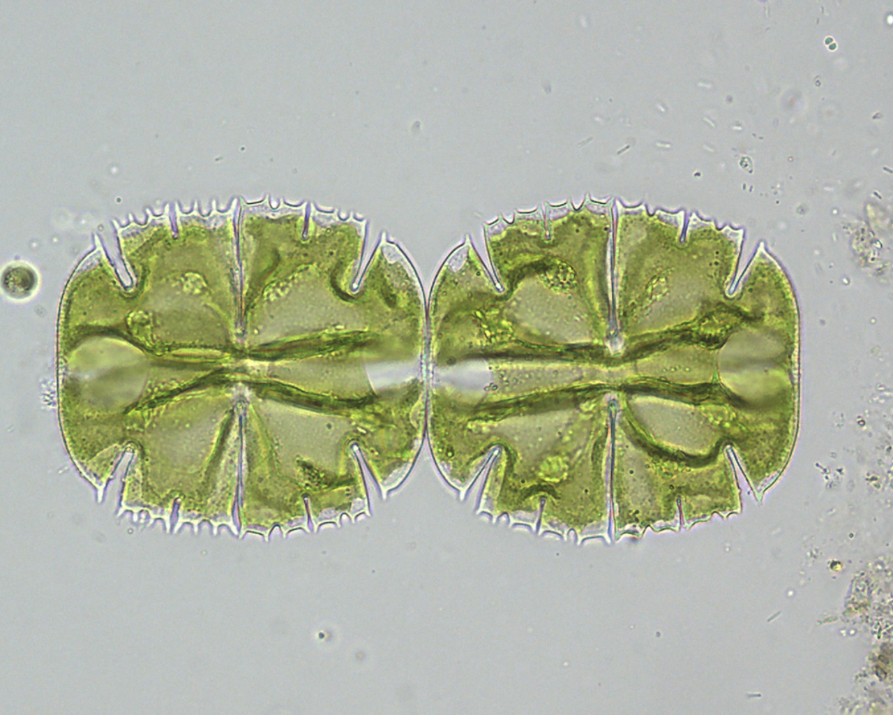 Vennendag 2025 Micrasterias truncata