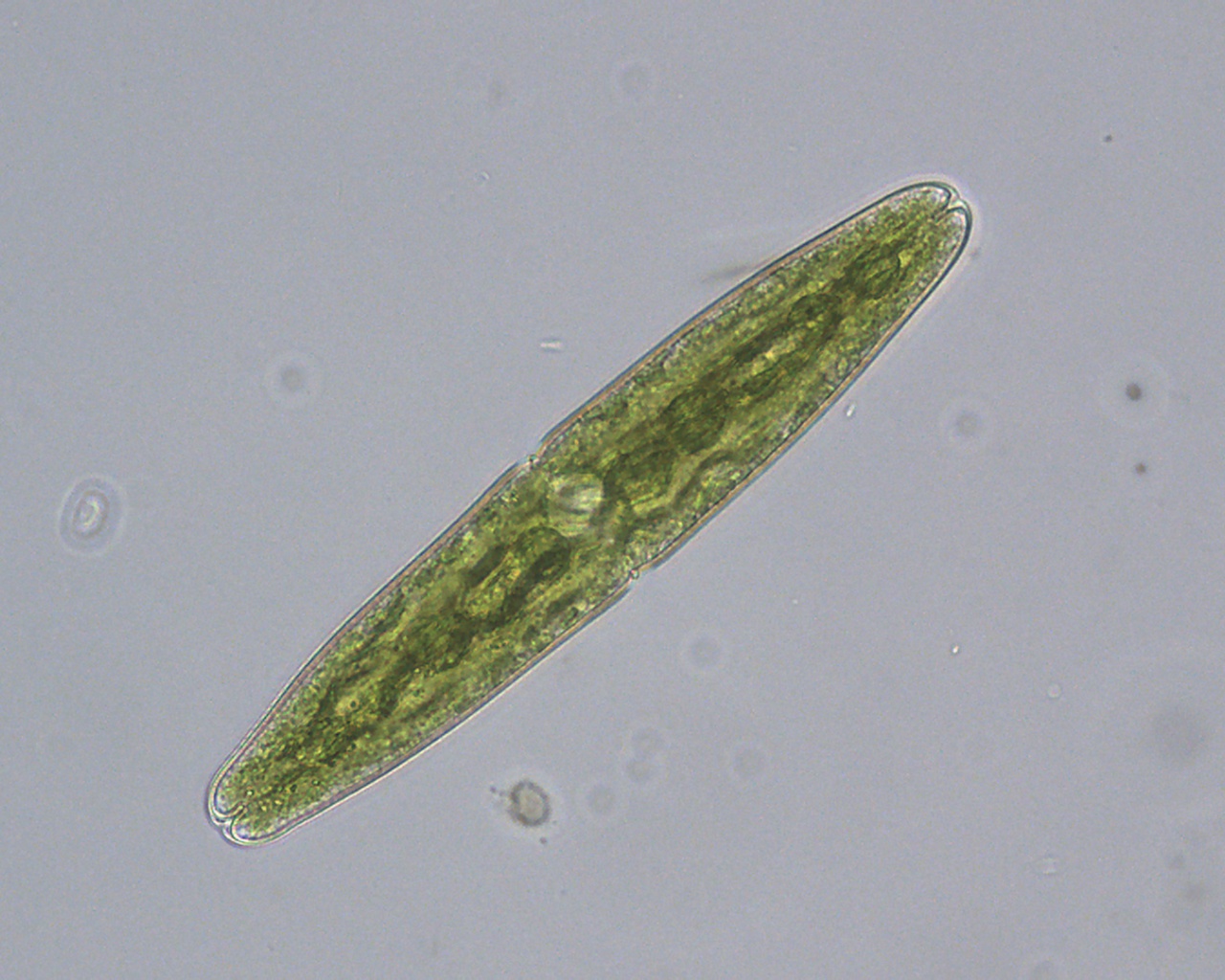 Tetmemorus granulatus