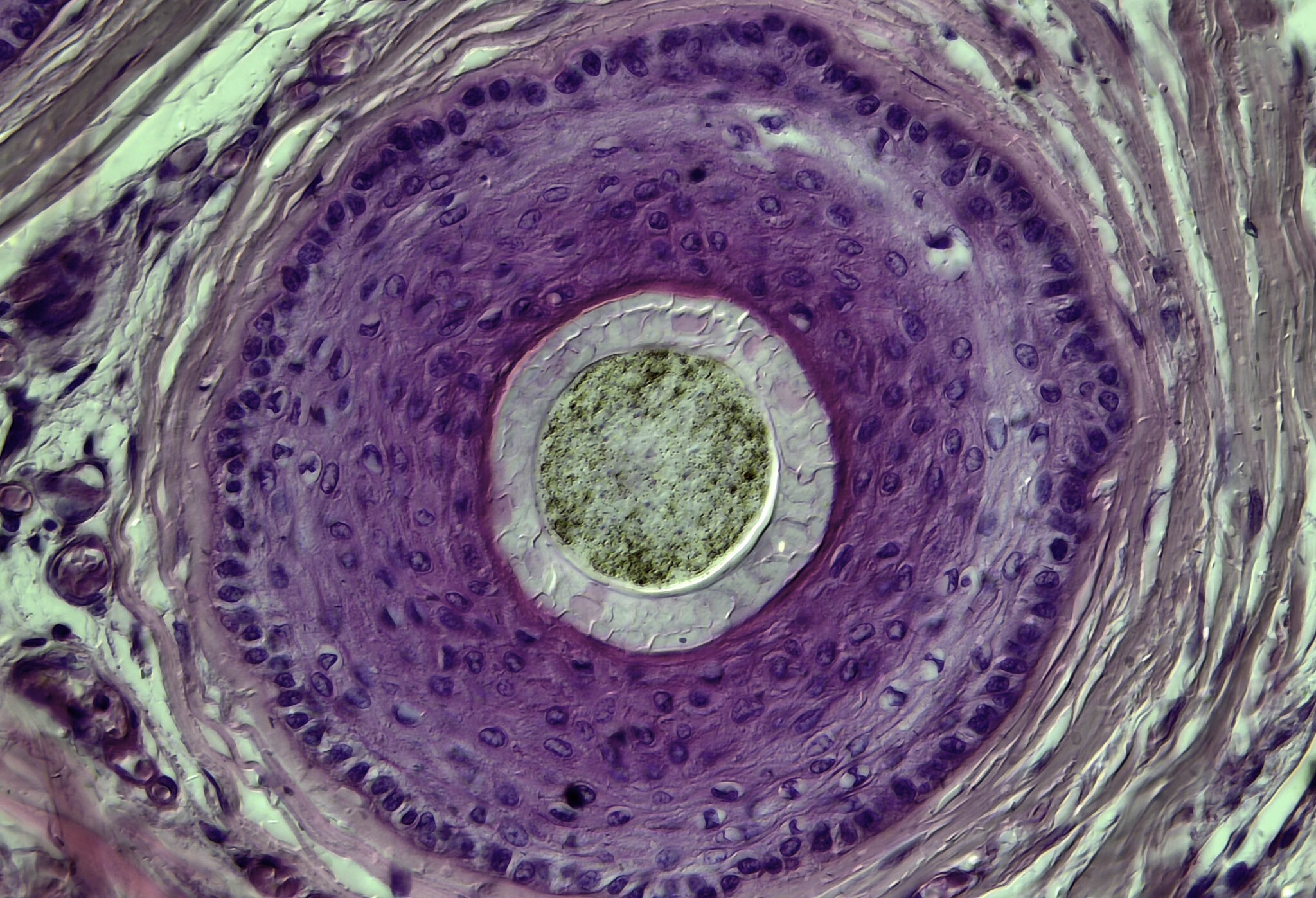 Een doorsnede van een stukje mannenhuis met baardhaar.