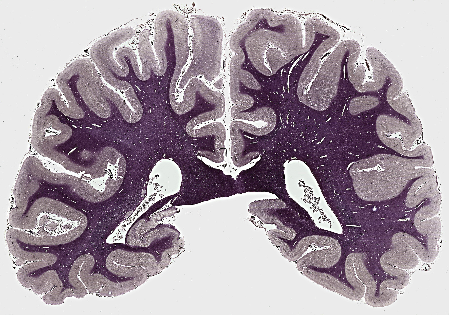 Menselijke hersenen doorsnede